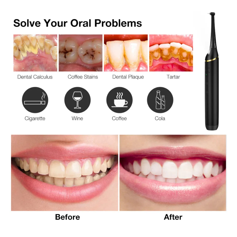 Vibe Geeks USB Rechargeable Electric Dental Calculus Tooth